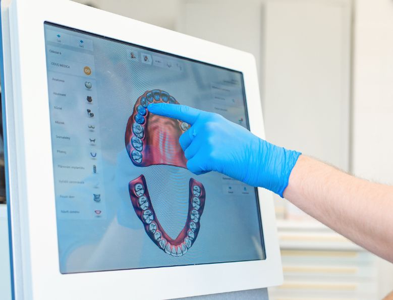Studio Dentistico Rossi Zanon | Ortodonzia Digitale